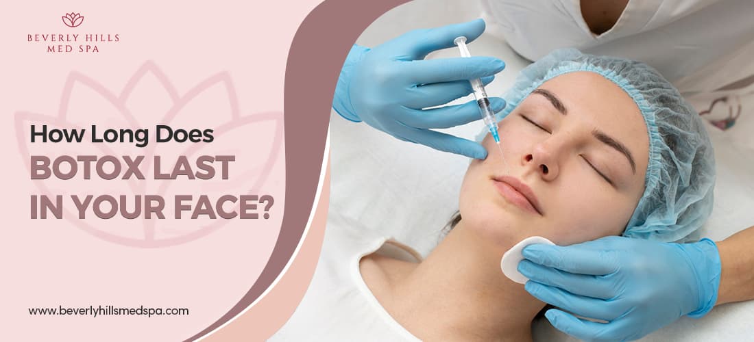 How Long Does Botox Last