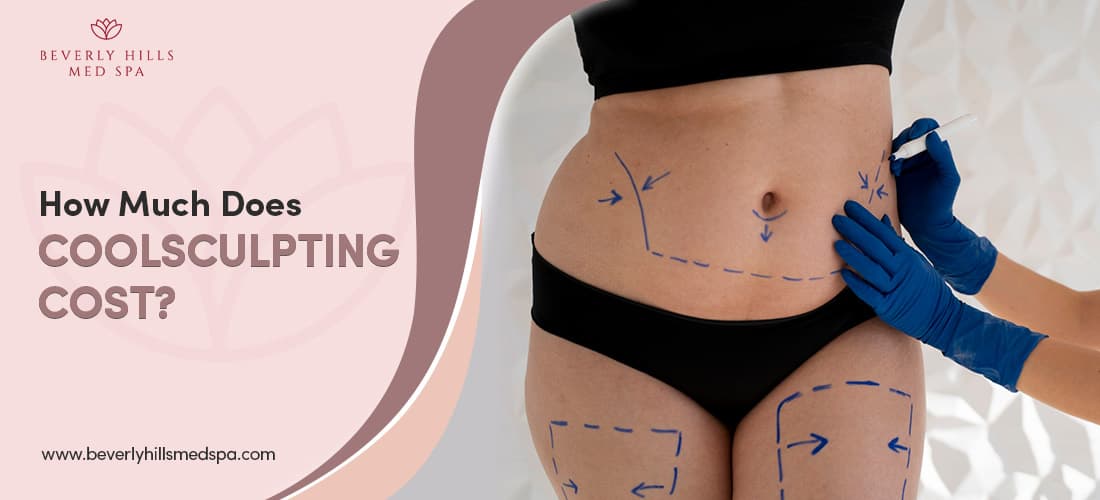 How Much Does CoolSculpting Cost Featured Image