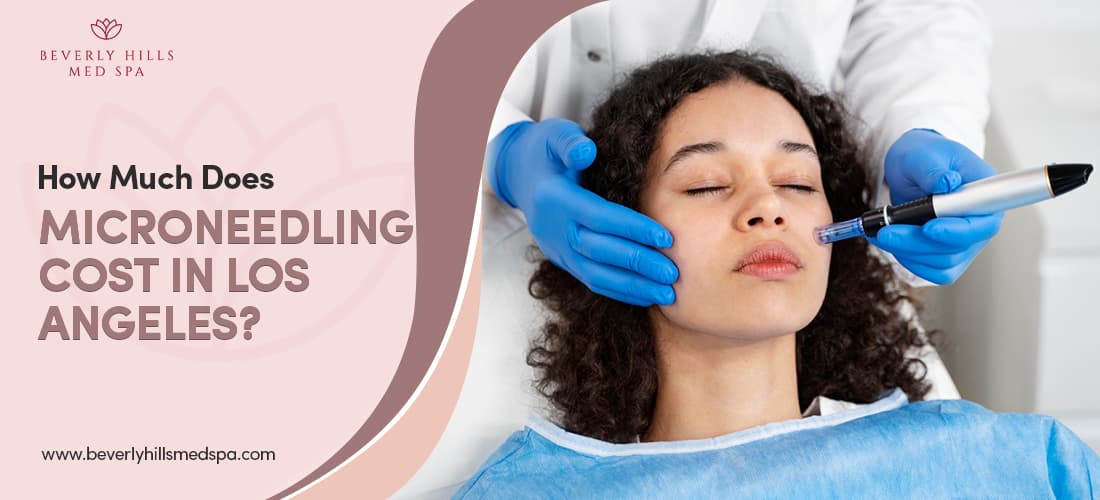 How Much Does Microneedling Cost in Los Angeles Featured Image