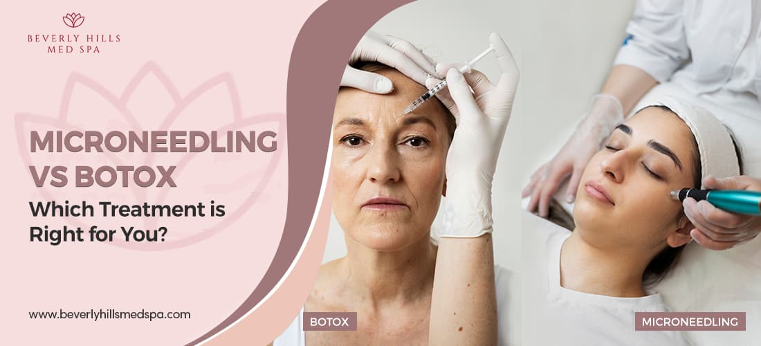 Microneedling vs Botox: Which Treatment is Right for You?