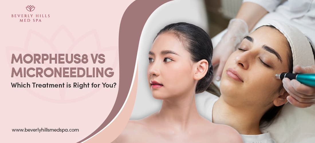 Morpheus8 vs Microneedling Which Treatment is Right for You Featured Image 1