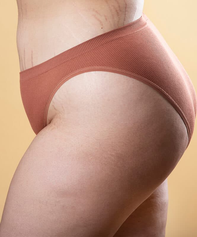 What is Brazilian Butt Lift