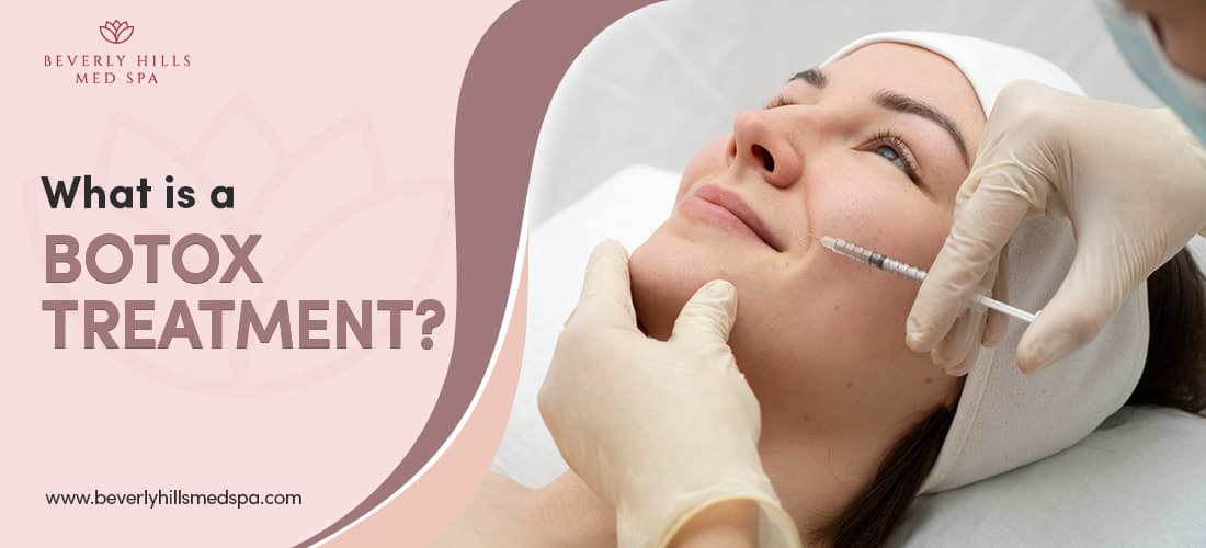 What is a Botox treatment Featured Image