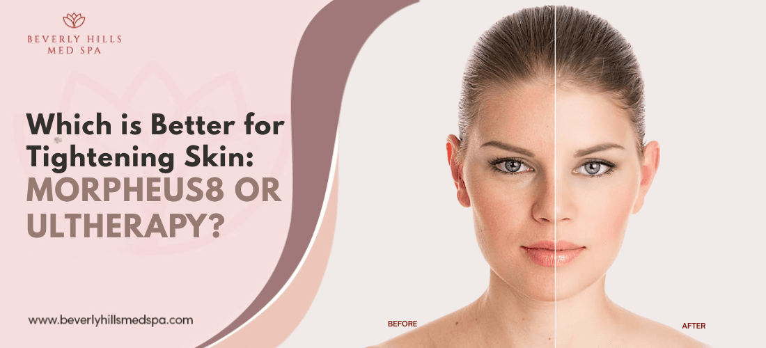 Which is Better for Tightening Skin Morpheus8 vs Ultherapy