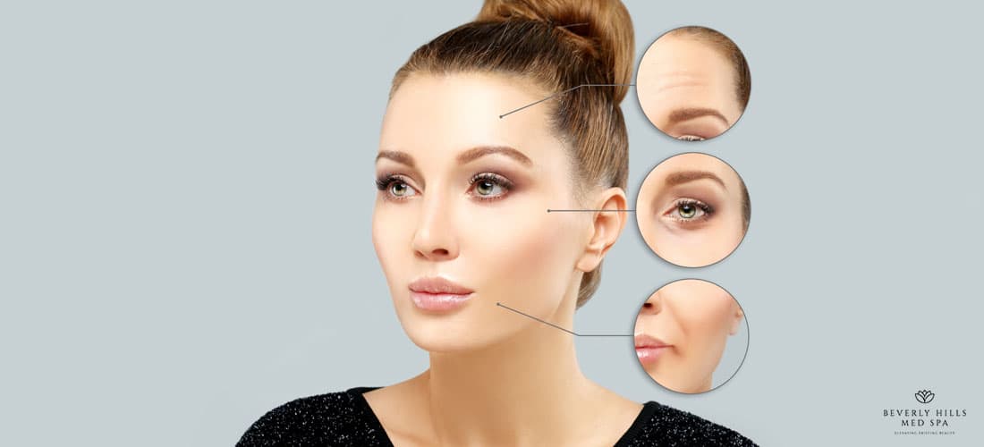 Botox Aftercare: Things you Should Avoid After Botox Treatment