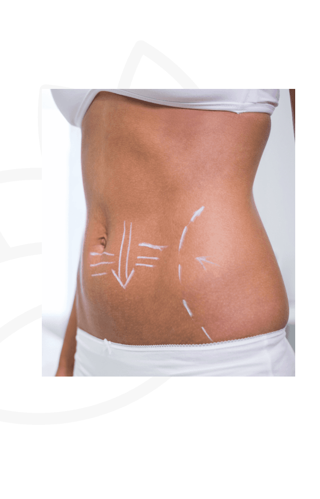 Why Choose Fat Reduction