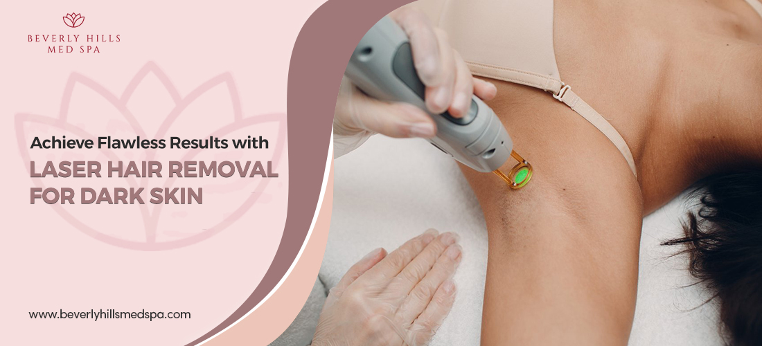 laser-hair-removal-for-dark-skin